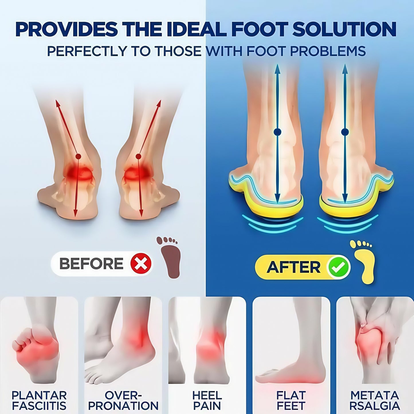 Plantar Fasciitis High Arch Shock Absorbing Insoles