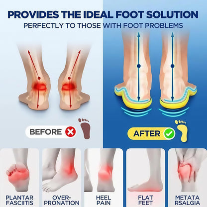 Plantar Fasciitis High Arch Shock Absorbing Insoles
