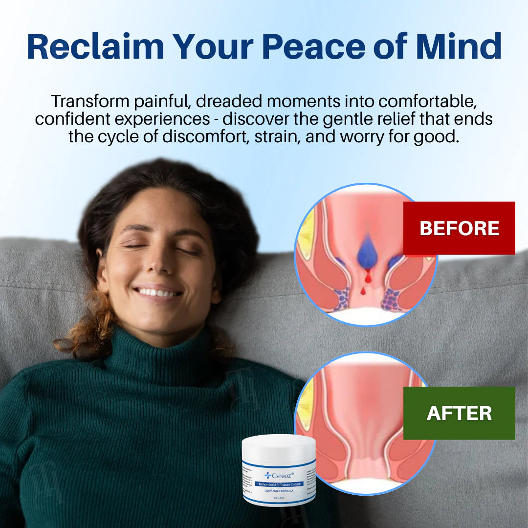 🏆Official Store|70% Off! Cvreoz® Hemorrhoid & Fissure Cream