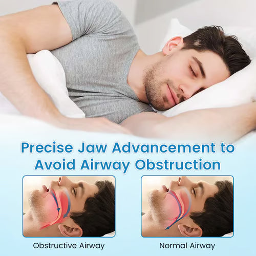 ✨[Official Brand Store] BBOJI™ Adjustable Anti-Snoring Mouthpiece Universal Size